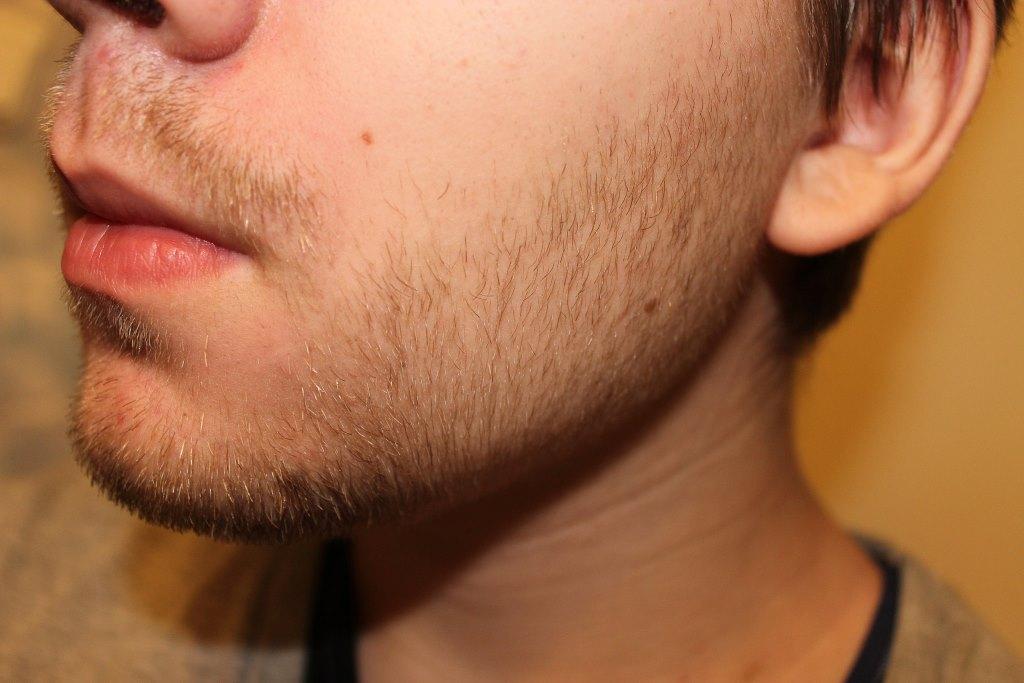 как должна расти борода в 20 лет