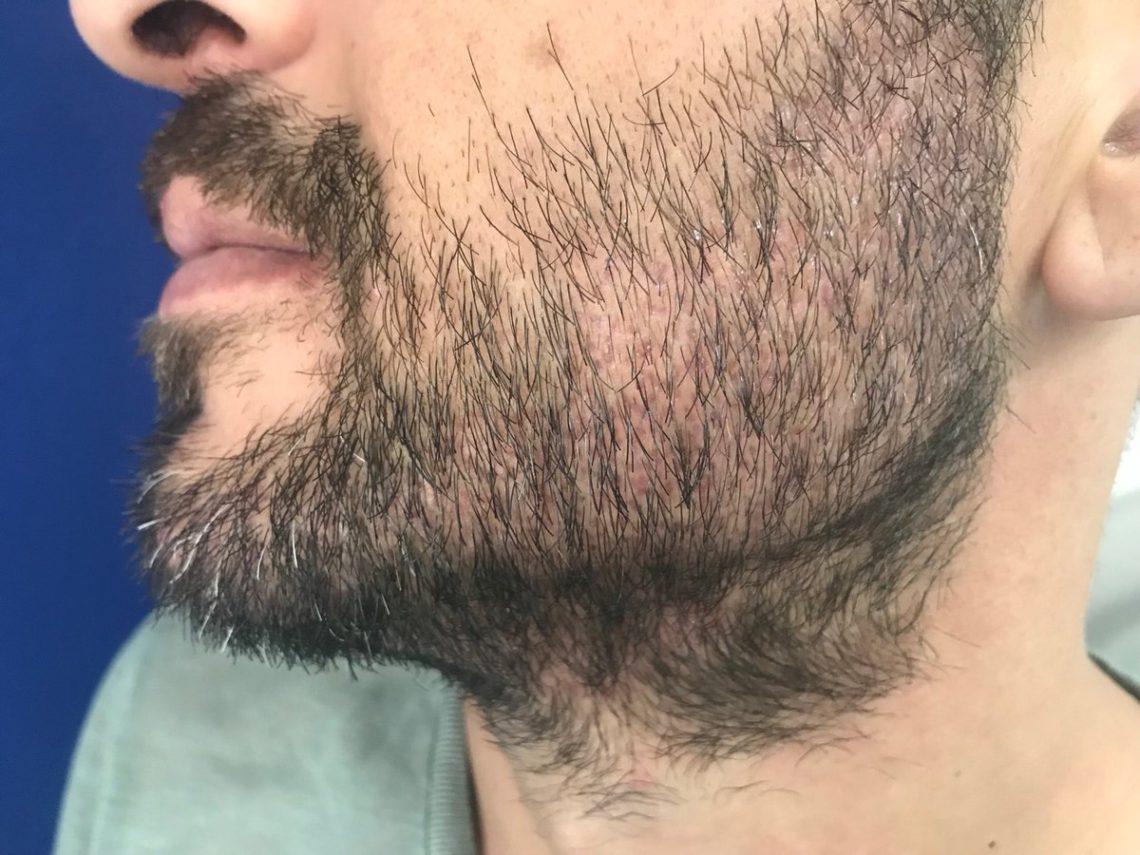 почему мужчины отращивают бороду