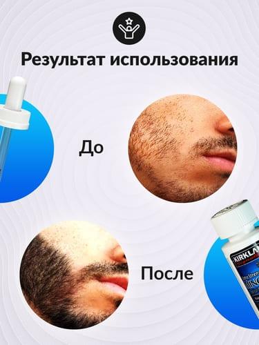 Minoxidil для роста бороды: все, что вам нужно знать!